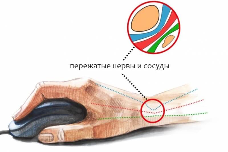 Как зайти на кракен с айфона